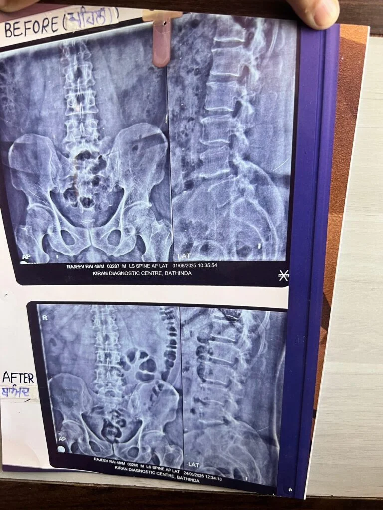 Before and After Treatment